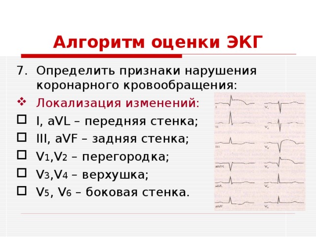 Отведения 2 3 avf какая стенка