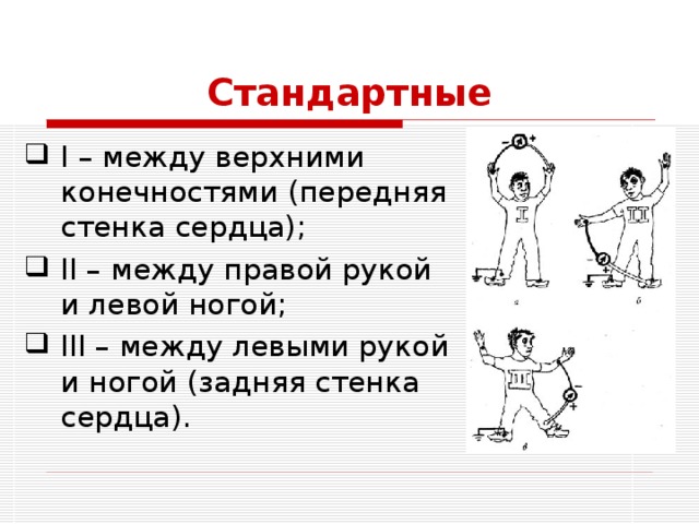 Стандартные I – между верхними конечностями (передняя стенка сердца); II – между правой рукой и левой ногой; III – между левыми рукой и ногой (задняя стенка сердца). 