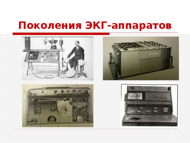 Поколения ЭКГ-аппаратов 