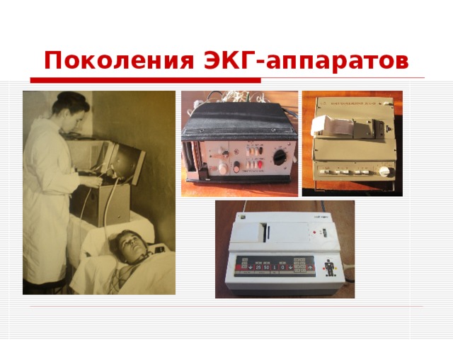 Поколения ЭКГ-аппаратов 