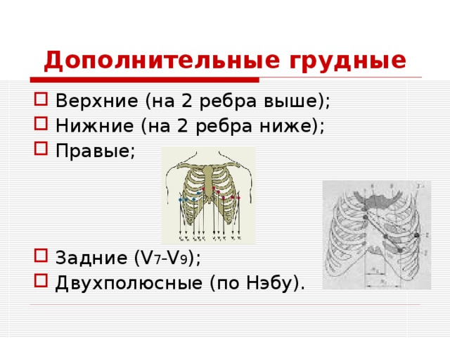 Дополнительные грудные Верхние (на 2 ребра выше); Нижние (на 2 ребра ниже); Правые;    Задние (V 7 -V 9 ); Двухполюсные (по Нэбу). 