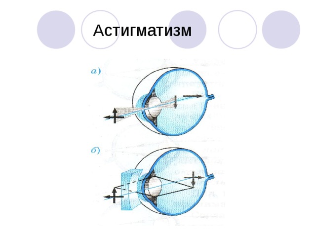 Как фокусируется изображение рассматриваемого предмета при астигматизме