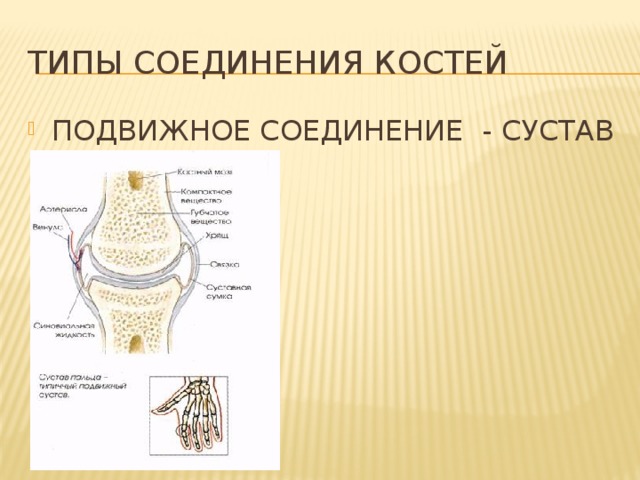 Типы соединения костей ПОДВИЖНОЕ СОЕДИНЕНИЕ - СУСТАВ 