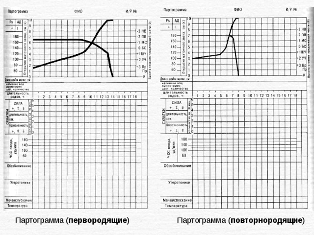 Партограмма в акушерстве как заполнять образец заполнения