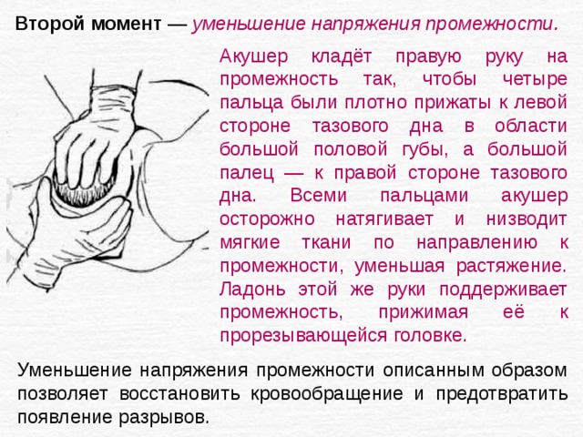 Второй момент — уменьшение напряжения промежности. Акушер кладёт правую руку на промежность так, чтобы четыре пальца были плотно прижаты к левой стороне тазового дна в области большой половой губы, а большой палец — к правой стороне тазового дна. Всеми пальцами акушер осторожно натягивает и низводит мягкие ткани по направлению к промежности, уменьшая растяжение. Ладонь этой же руки поддерживает промежность, прижимая её к прорезывающейся головке. Уменьшение напряжения промежности описанным образом позволяет восстановить кровообращение и предотвратить появление разрывов. 