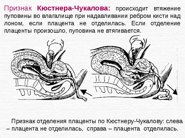 Плацента и пуповина фото