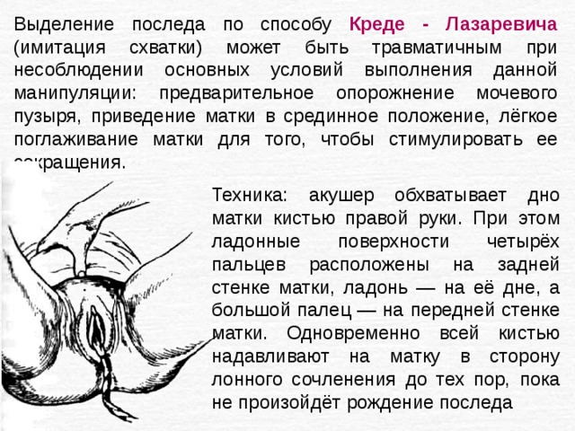 Выделение последа по способу Креде - Лазаревича  (имитация схватки) может быть травматичным при несоблюдении основных условий выполнения данной манипуляции: предварительное опорожнение мочевого пузыря, приведение матки в срединное положение, лёгкое поглаживание матки для того, чтобы стимулировать ее сокращения. Техника: акушер обхватывает дно матки кистью правой руки. При этом ладонные поверхности четырёх пальцев расположены на задней стенке матки, ладонь — на её дне, а большой палец — на передней стенке матки. Одновременно всей кистью надавливают на матку в сторону лонного сочленения до тех пор, пока не произойдёт рождение последа 
