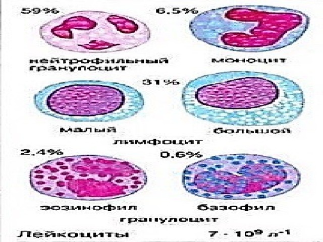 Лейкоциты Лейкоциты Агранулоциты Гранулоциты Нейтрофилы Базофилы Моноциты Эозинофилы Лимфоциты Т-лимфоциты В-лимфоциты Т-хелперы Т-супрессоры Т-киллеры Плазматические клетки Делятся на две группы К-ки иммунной памяти Лейкоциты, или белые кровяные тельца, образуются в красном костном мозге, лимфатических узлах и селезенке. Продолжительность жизни 8-12 суток. Имеют ядро способны к движению за счет псевдоподий, т.о. форма этих клеток непостоянна. В 1 мкл человека в среднем 4000-8000 лейкоцитов.  Гранулоциты : Нейтрофилы – окрашивание в ней-ые цвета. Эозинофилы – окрашивание в кислые цвета. Базофилы – окрашивание в щелочные красители 