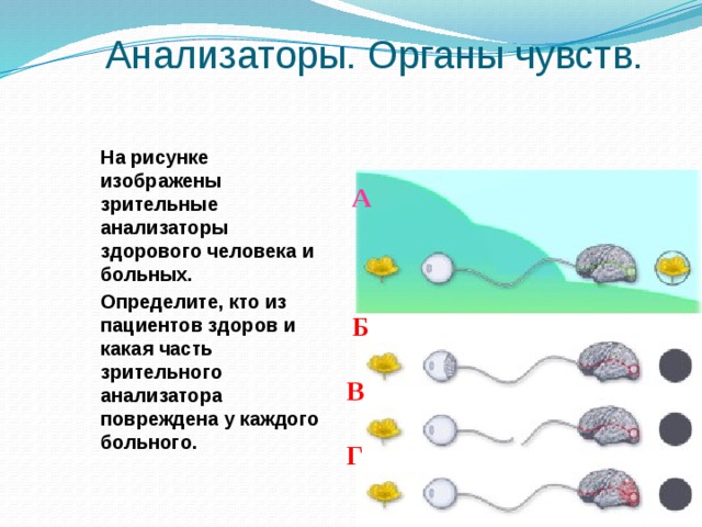 Анализаторы. Органы чувств. На рисунке изображены зрительные анализаторы здорового человека и больных. Определите, кто из пациентов здоров и какая часть зрительного анализатора повреждена у каждого больного. А Б В Г 