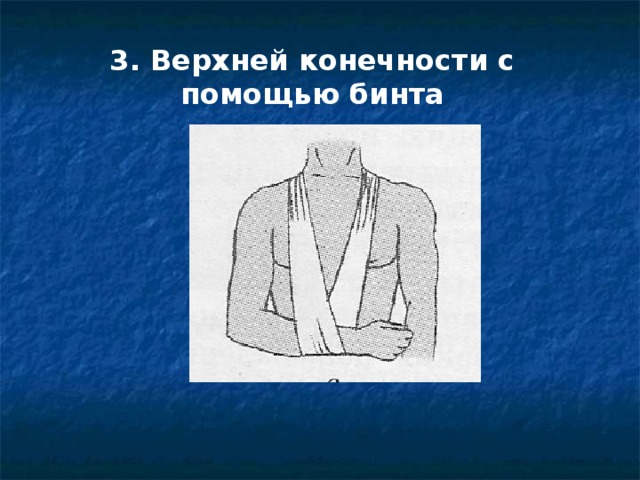 3. Верхней конечности с помощью бинта 