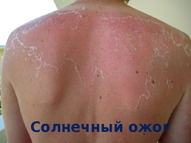 Презентация урока безопасности на летних каникулах
