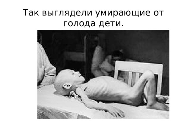 Так выглядели умирающие от голода дети. 