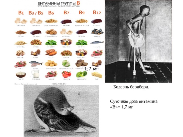 1,7 мг Болезнь берибери. Суточная доза витамина «В»= 1,7 мг 