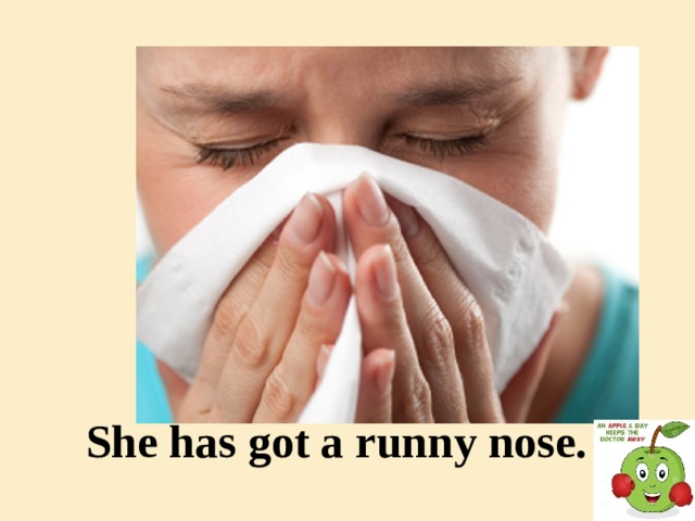 She has got a runny nose.