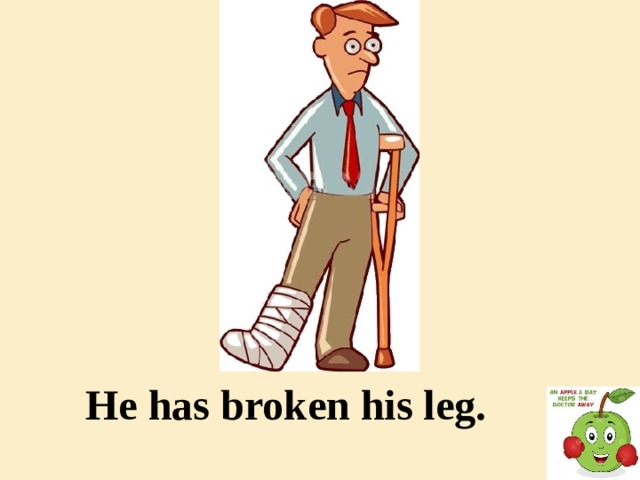 He has broken his leg.