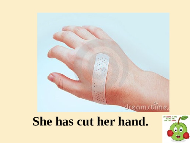 She has cut her hand.