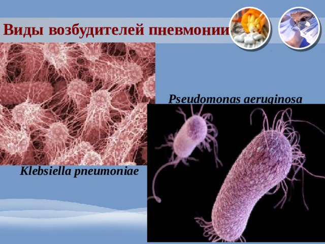 Виды возбудителей пневмонии Pseudomonas aeruginosa Klebsiella pneumoniae 