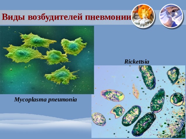 Виды возбудителей пневмонии Rickettsia Mycoplasma pneumonia 