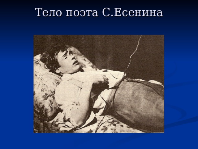 Тело поэта С.Есенина   