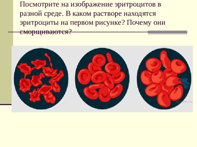  Посмотрите на изображение эритроцитов в разной среде. В каком растворе находятся эритроциты на первом рисунке? Почему они сморщиваются?    