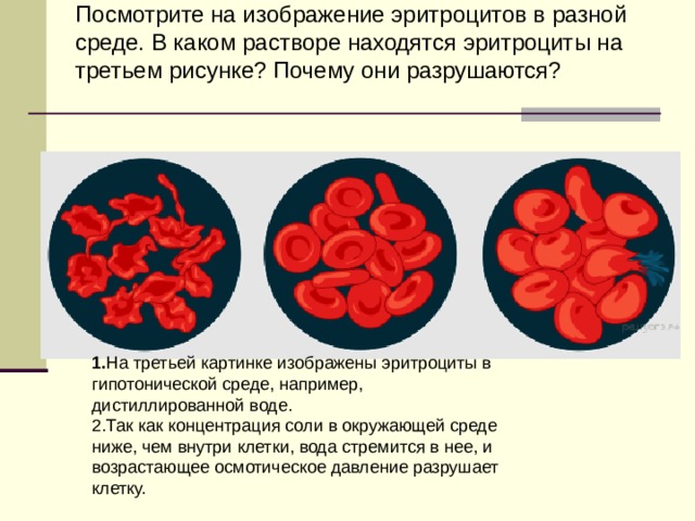     Посмотрите на изображение эритроцитов в разной среде. В каком растворе находятся эритроциты на третьем рисунке? Почему они разрушаются? 1. На третьей картинке изображены эритроциты в гипотонической среде, например, дистиллированной воде. 2.Так как концентрация соли в окружающей среде ниже, чем внутри клетки, вода стремится в нее, и возрастающее осмотическое давление разрушает клетку. 