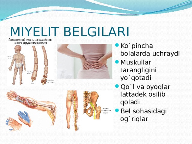 MIYELIT BELGILARI Ko`pincha bolalarda uchraydi Muskullar tarangligini yo`qotadi Qo`l va oyoqlar lattadek osilib qoladi Bel sohasidagi og`riqlar 