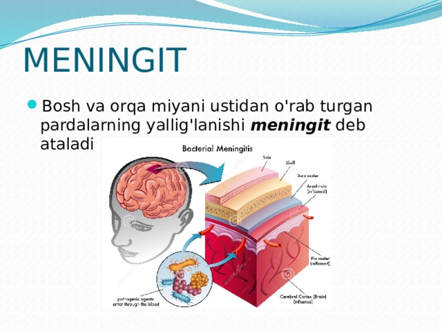 MENINGIT Bosh va orqa miyani ustidan o'rab turgan pardalarning yallig'lanishi meningit deb ataladi 