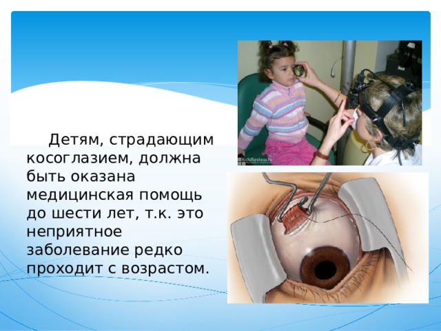  Детям, страдающим косоглазием, должна быть оказана медицинская помощь до шести лет, т.к. это неприятное заболевание редко проходит с возрастом. 