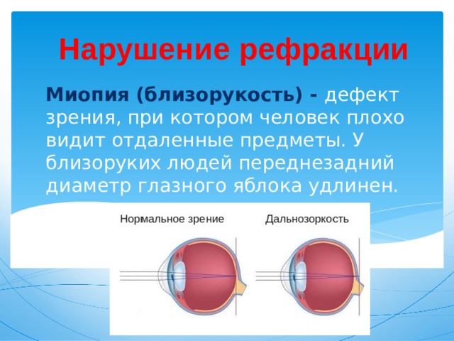 Рефракция презентация қазақша