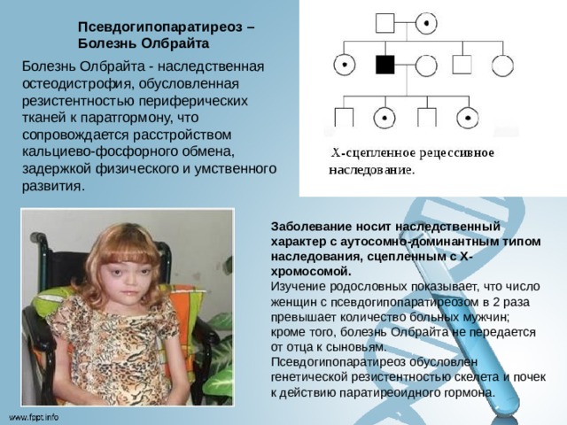 Псевдогипопаратиреоз – Болезнь Олбрайта Болезнь Олбрайта - наследственная остеодистрофия, обусловленная резистентностью периферических тканей к паратгормону, что сопровождается расстройством кальциево-фосфорного обмена, задержкой физического и умственного развития. Заболевание носит наследственный характер с аутосомно-доминантным типом наследования, сцепленным с X-хромосомой. Изучение родословных показывает, что число женщин с псевдогипопаратиреозом в 2 раза превышает количество больных мужчин; кроме того, болезнь Олбрайта не передается от отца к сыновьям. Псевдогипопаратиреоз обусловлен генетической резистентностью скелета и почек к действию паратиреоидного гормона.  