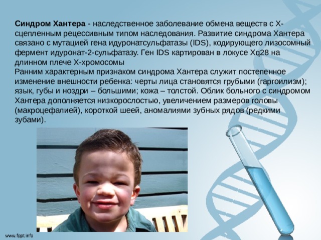 Синдром Хантера  - наследственное заболевание обмена веществ с Х-сцепленным рецессивным типом наследования. Развитие синдрома Хантера связано с мутацией гена идуронатсульфатазы (IDS), кодирующего лизосомный фермент идуронат-2-сульфатазу. Ген IDS картирован в локусе Xq28 на длинном плече Х-хромосомы  Ранним характерным признаком синдрома Хантера служит постепенное изменение внешности ребенка: черты лица становятся грубыми (гаргоилизм); язык, губы и ноздри – большими; кожа – толстой. Облик больного с синдромом Хантера дополняется низкорослостью, увеличением размеров головы (макроцефалией), короткой шеей, аномалиями зубных рядов (редкими зубами). 