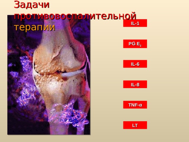 Задачи противовоспалительной  терапии IL-1 PG E 2 IL-6 IL-8 TNF- α LT 