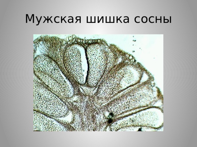 Клетки хвойных. Микропрепарат мужской шишки сосны сосны. Пыльца сосны микропрепарат. Мужская шишка сосны микропрепарат. Микропрепарат мужская шишка сосны под микроскопом.