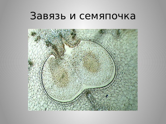 Поперечный срез завязи пестика лилии. Завязь и семяпочка под микроскопом. Завязь и семяпочка. Завязь и семяпочка строение. Семяпочка под микроскопом.