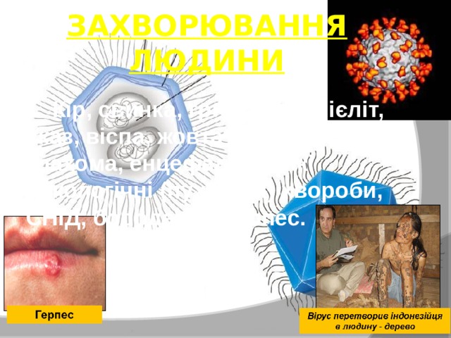ЗАХВОРЮВАННЯ ЛЮДИНИ Кір, свинка, грип, поліомієліт, сказ, віспа, жовта лихоманка, трахома, енцефаліт, деякі онкологічні (пухлинні) хвороби, СНІД, бородавки, герпес. 