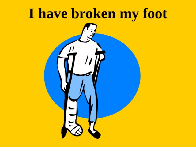 I have broken my foot 