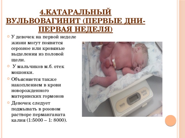 у новорожденного отмечается физиологическая гипертония