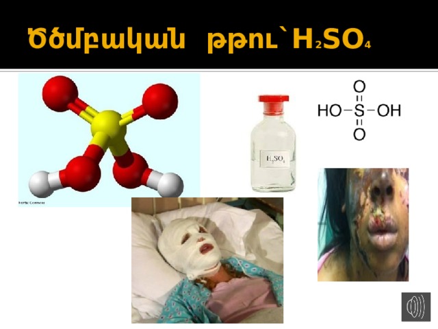 Ծծմբական թթու`H 2 SO 4 