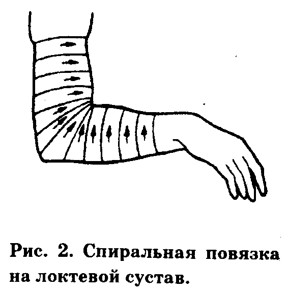 Перевязка локтя. Спиральная перевязка на локтевой сустав. Наложение сходящейся повязки на локтевой сустав. Сходящаяся черепашья повязка на локтевой сустав алгоритм. Перевязка черепашья сходящаяся на локоть.