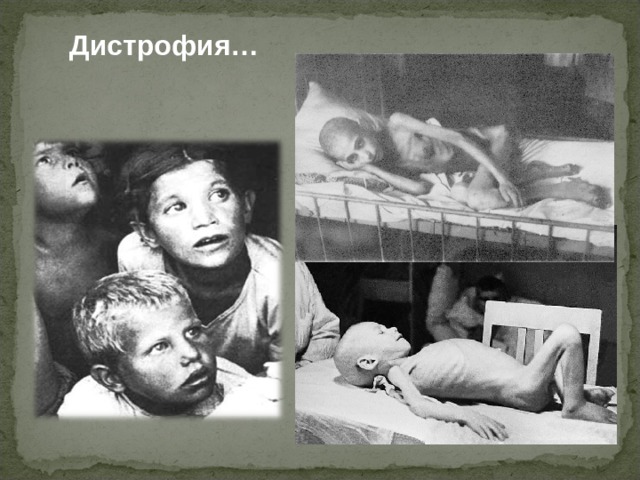 Дистрофия… 