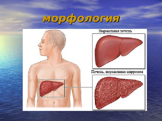 морфология 