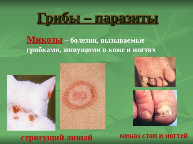 Грибы – паразиты Микозы – болезни, вызываемые грибками, живущими в коже и ногтях микоз стоп и ногтей стригущий лишай 