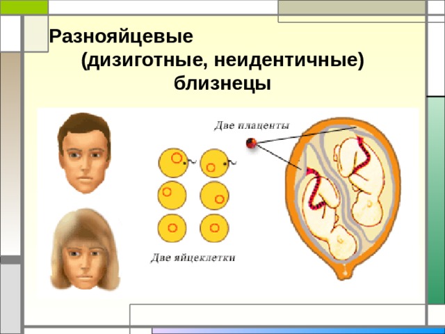 Дизиготные близнецы. Разнояйцевые. Разнояйцевые или дизиготные. Дизиготные однояйцевые. 6. Дизиготные (двуяйцевые, неидентичные) Близнецы.