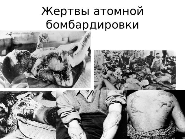 Жертвы атомной бомбардировки