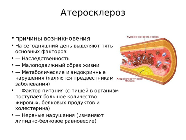 Атеросклероз   причины возникновения На сегодняшний день выделяют пять основных факторов: — Наследственность — Малоподвижный образ жизни — Метаболические и эндокринные нарушения (являются предвестниками заболевания) — Фактор питания (с пищей в организм поступает большое количество жировых, белковых продуктов и холестерина) — Нервные нарушения (изменяют липидно-белковое равновесие) 