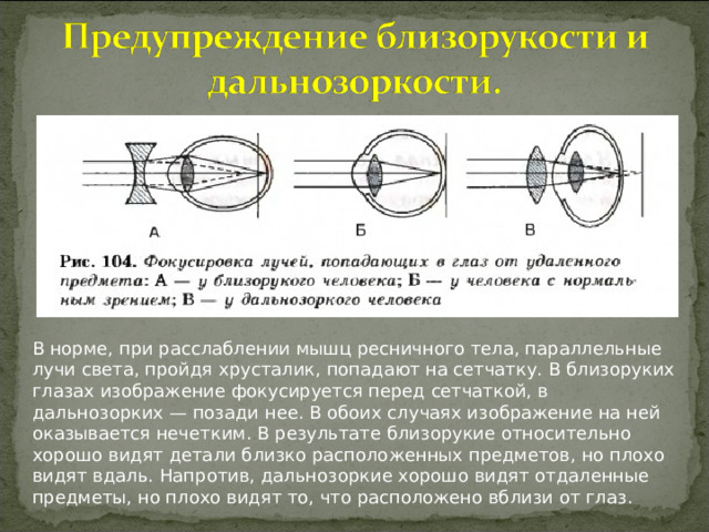 В норме, при расслаблении мышц ресничного тела, параллельные лучи света, пройдя хрусталик, попадают на сетчатку. В близоруких глазах изображение фокусируется перед сетчаткой, в дальнозорких — позади нее. В обоих случаях изображение на ней оказывается нечетким. В результате близорукие относительно хорошо видят детали близко расположенных предметов, но плохо видят вдаль. Напротив, дальнозоркие хорошо видят отдаленные предметы, но плохо видят то, что расположено вблизи от глаз.  