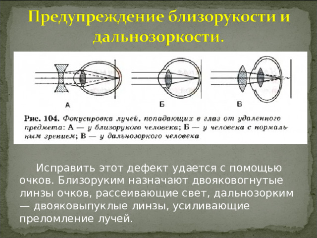  Исправить этот дефект удается с помощью очков. Близоруким назначают двояковогнутые линзы очков, рассеивающие свет, дальнозорким — двояковыпуклые линзы, усиливающие преломление лучей. 