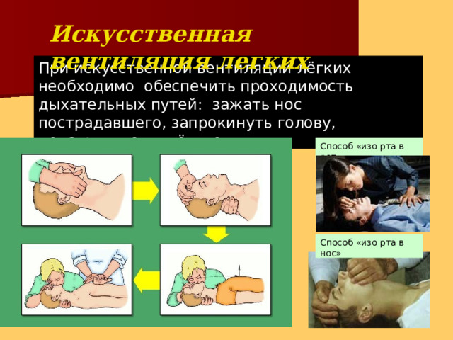 Искусственная вентиляция  легких При искусственной вентиляции лёгких необходимо обеспечить проходимость дыхательных путей: зажать нос пострадавшего, запрокинуть голову, делать выдох в лёгкие. Способ «изо рта в  рот» Способ «изо рта в  нос» 