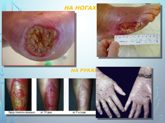 НА НОГАХ НА РУКАХ 