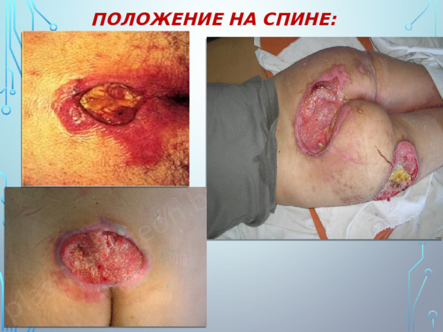 ПОЛОЖЕНИЕ НА СПИНЕ: 